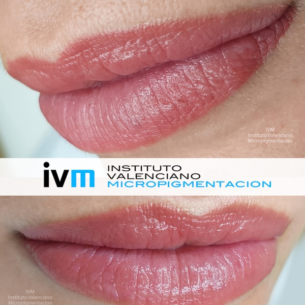 MICROPIGMENTACION_LABIOS_IVM