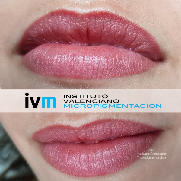 MICROPIGMENTACION_LABIOS_IVM