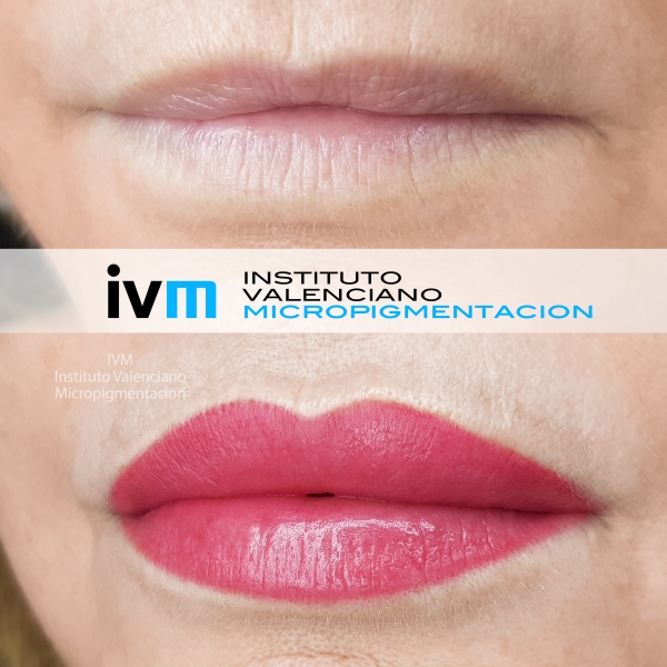 MICROPIGMENTACION_LABIOS_IVM