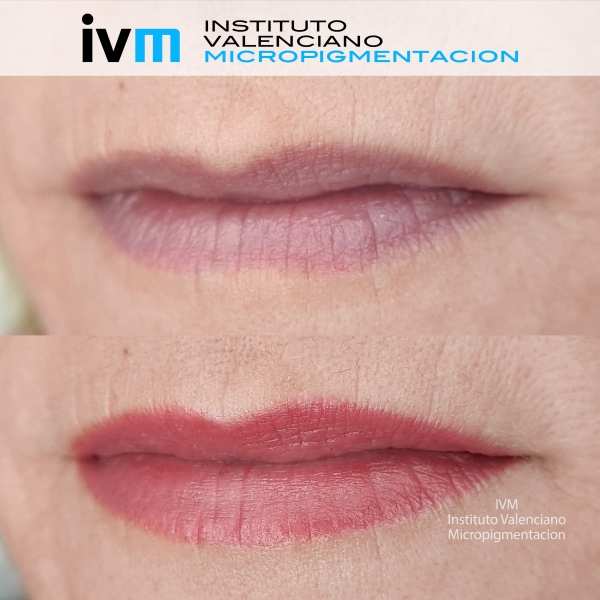 MICROPIGMENTACION_LABIOS_IVM