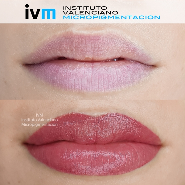 MICROPIGMENTACION_LABIOS_IVM