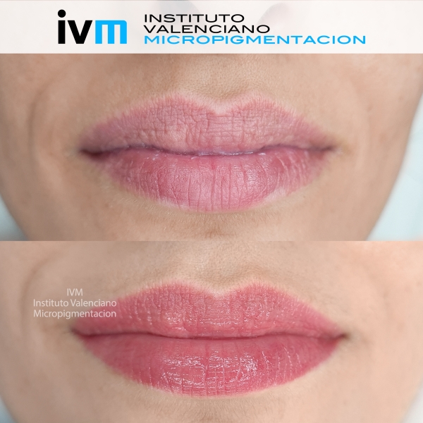 MICROPIGMENTACION_LABIOS_IVM