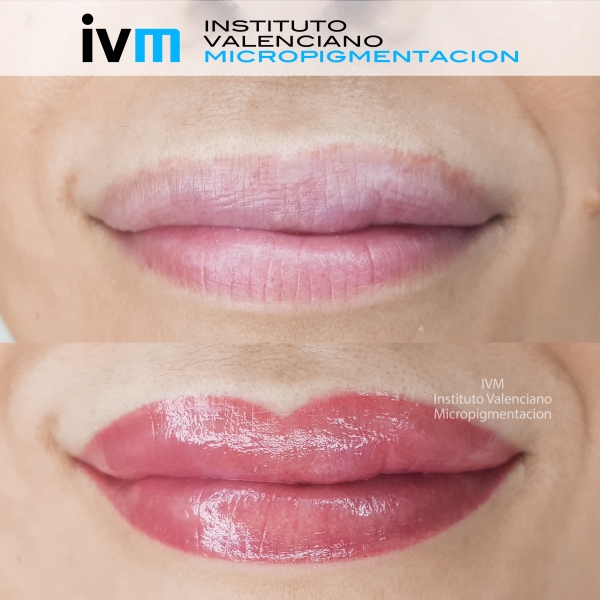 MICROPIGMENTACION_LABIOS_IVM