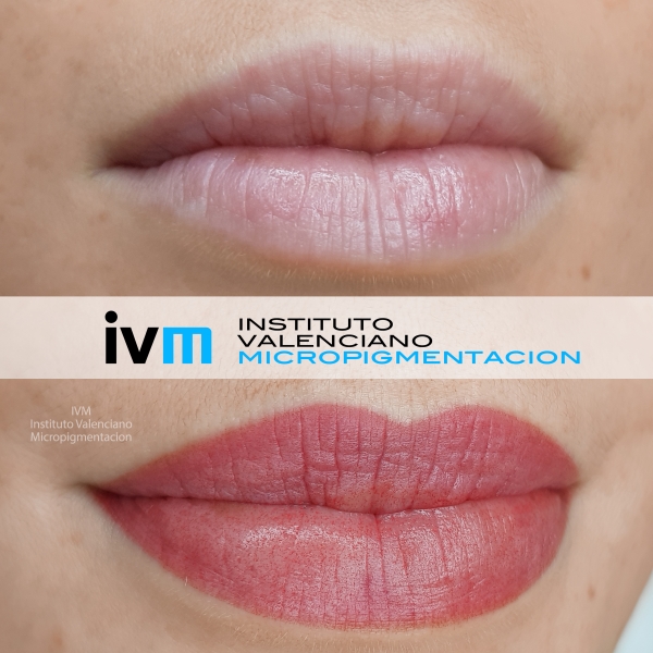 MICROPIGMENTACION_LABIOS_IVM