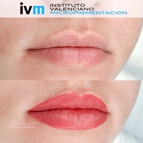 MICROPIGMENTACION_LABIOS_IVM