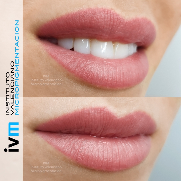 MICROPIGMENTACION_LABIOS_IVM