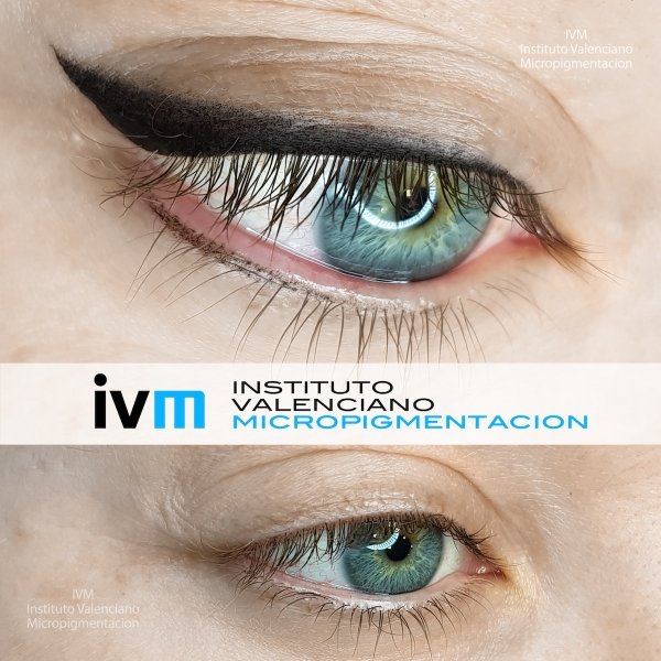 MICROPIGMENTACION-EYELINER-IVM