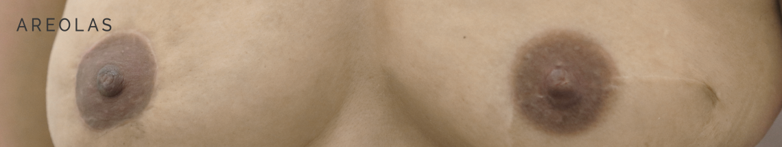 Micropigmentacion areolas