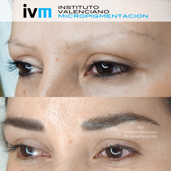 MICROPIGMENTACION-CEJAS-IVM