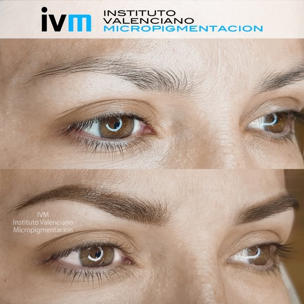 MICROPIGMENTACION-CEJAS-IVM