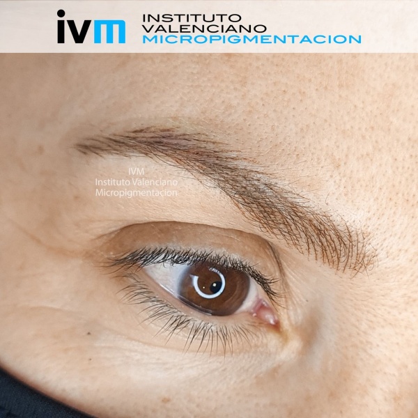 MICROPIGMENTACION-CEJAS-IVM