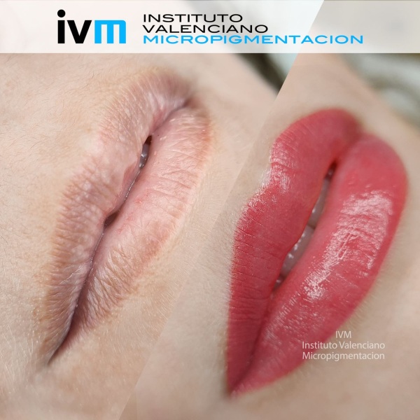 MICROPIGMENTACION_LABIOS_IVM