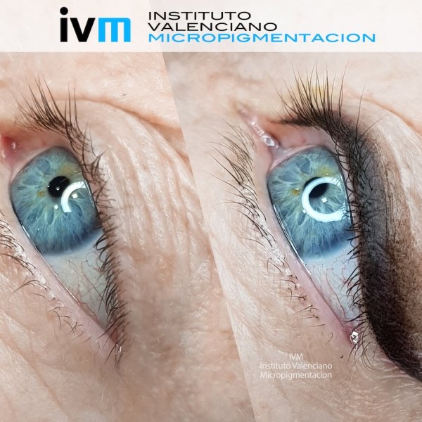MICROPIGMENTACION-EYELINER-IVM